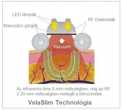 Mire jó a vákuum technológia?